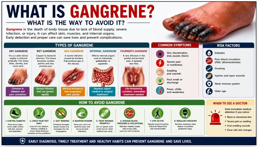 What Is Gangrene?