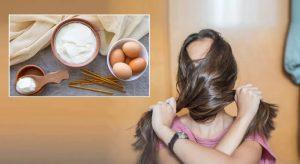 Read more about the article Home Remedies to Use Eggs for Hair Care