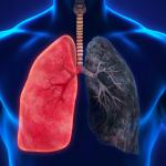 What happens to the lungs after smoking and what happens to the body from the moment you quit?