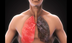 Smoking Impacts on Lung